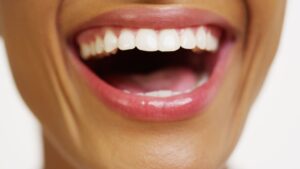 Close-up of a woman's bright white smile