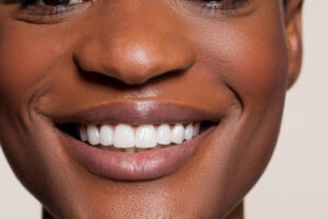Close-up of a woman's bright, white smile